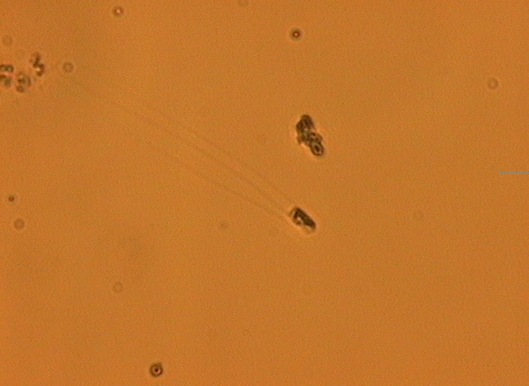Dictyocha speculum